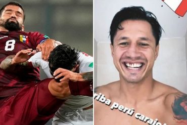 ¡MUY RUDO! Así le quedaron los dientes a este futbolista peruano tras duro choque con Tomás Rincón (+Foto)