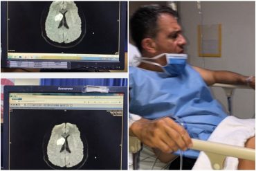 ¡SEPA! Excarcelaron al general Pedro Naranjo luego de que se le detectó un tumor cerebral: estuvo en la Dgcim acusado de supuesta conspiración