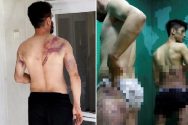 ¡GRAVE! Dos periodistas afganos fueron cruelmente golpeados por talibanes: “Me tumbaron en el suelo y me golpearon con palos, cables y tubos” (+Fotos sensibles)