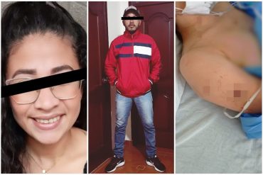 ¡ALARMANTE! “Me dijo que la próxima no la vuelvo a contar”: Venezolana en Ecuador que fue atacada por su exnovio con un destornillador teme por su vida