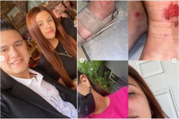 ¡TERRIBLE! “Me espera siempre en un carro distinto”: Modelo venezolana en Miami denunció acoso de su expareja y compartió impactantes pruebas de sus agresiones (+Videos)