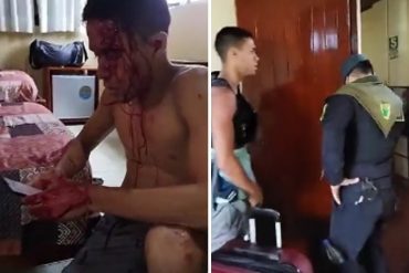 ¡GRAVE! Venezolano agredido brutalmente por funcionario de la Policía de Perú denunció la “complicidad” de una fiscal: “Me aisló por 48 horas” (+Videos)