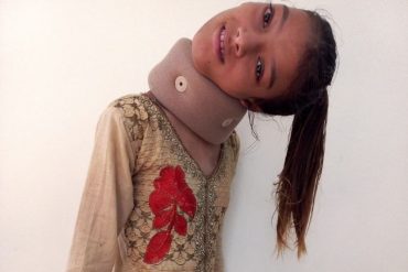 ¡IMPACTANTE! El impresionante caso de Afsheen Gul, la adolescente pakistaní que ha tenido que vivir durante años con el cuello rotado a 90 grados (+Fotos)