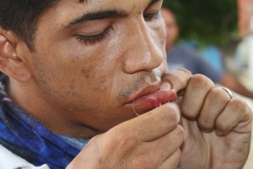 ¡PROTESTA! Migrantes venezolanos se cosieron la boca para presionar a autoridades de México