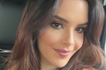 ¡VÉALA! Miss Venezuela 2021: Amanda Dudamel terminó con el misterio y mostró su nueva sonrisa tras someterse a procedimientos para mejorarla