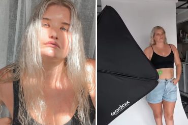 ¡MÍRELA! Todo el tiempo tiene una expresión de tristeza: joven con extraña condición que le impide sonreír pasó del bullying al modelaje (+Videos y fotos)