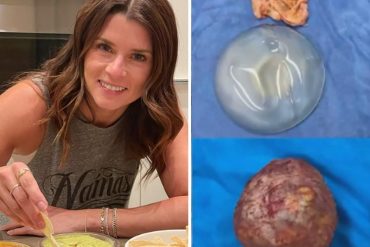 “Los senos no te harán perfecta”: la profunda reflexión de la ex piloto Danica Patrick sobre una cirugía de implantes mamarios (+Video)