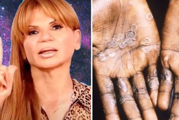 Mhoni Vidente cree que la viruela del mono se convertirá en pandemia: “Fue un complot de gente muy poderosa que está dominando los virus y los está mutando” (+Video)