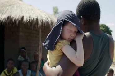 Cadena perpetua para un sujeto que junto a otras personas desmembró a su hermano albino para vender sus partes como “amuletos de suerte”