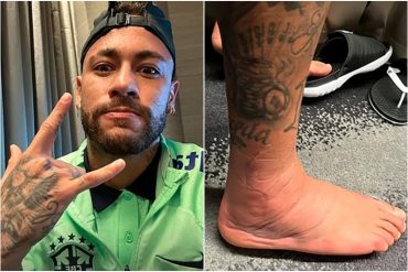 Neymar compartió la impactante imagen de su tobillo a 48 horas de su lesión: se perdería resto de los partidos