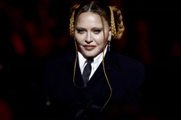 Madonna publica una imagen de su rostro en Instagram “después de su cirugía”