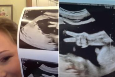 Bebé sorprende al “saludar” a sus padres durante la realización de una ecografía (+Video)