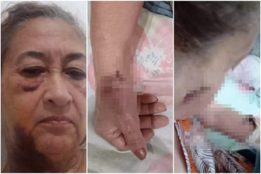 Docente venezolana denunció que fue apuñalada por una vecina en Argentina: “Decía que me odiaba y que soy una boluda”