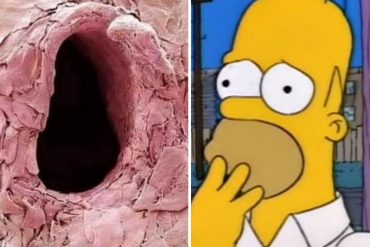 Publican cómo se ve con un microscopio el agujero en la piel que deja una aguja de inyectadora y se vuelve viral: “Todo me recuerda a ti” (+Reacciones)