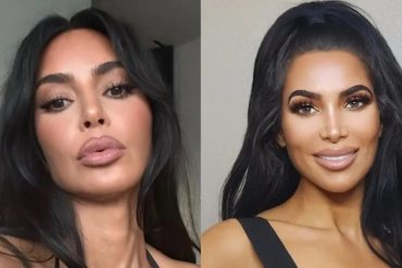 Muere tras someterse a otra cirugía de aumento de glúteos la modelo de TikTok y OnlyFans que llamaban “la doble” de Kim Kardashian