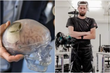 Con inteligencia artificial desarrollaron dispositivo cerebral que permitirá caminar a hombre con tetraplejía