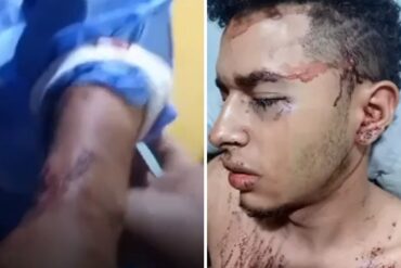 Venezolano sufrió brutal agresión en Perú tras reclamar a hombres que orinaron su moto (+Video)