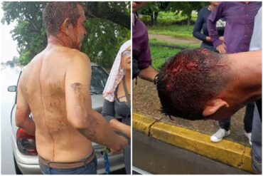 Capriles denunció que 10 personas resultaron heridas por agresiones de chavistas en Apure: “Hemos visto el rostro violento y fascista de quien está en el poder”