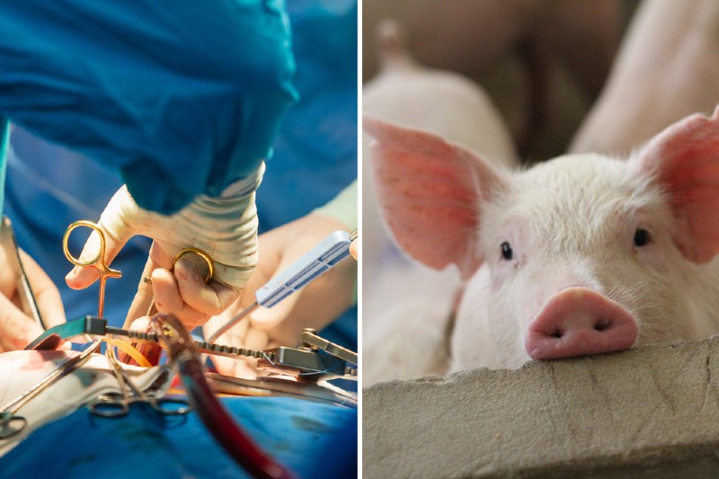 Médicos de EEUU logran que un riñón de cerdo funcione más de un mes en un cuerpo humano Médicos de EEUU logran que un riñón de cerdo funcione más de un mes en un cuerpo humano