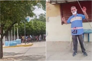 Denuncian que indígenas Yukpa atacaron a un adulto mayor en medio de enfrentamientos en Zulia (+Video)