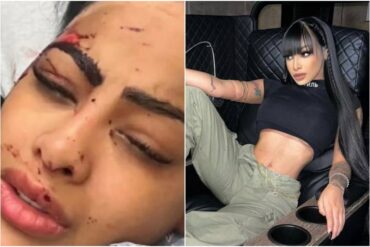 Una estilista venezolana reveló foto de Yailin La Más Viral con el rostro golpeado y en un hospital