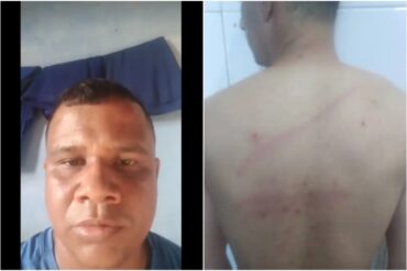 Denuncian que cuatro presos políticos fueron brutalmente agredidos en la Cárcel Yare II