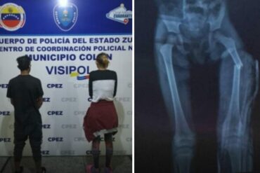 Detenida mujer en Zulia que le fracturó la pierna a su bebé de tres años en una golpiza