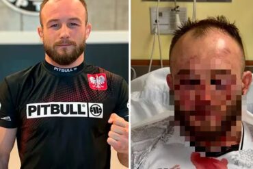 Estrella de la UFC terminó con el rostro desfigurado tras caer por nocaut y su foto se hace viral