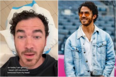 El músico Kevin Jonas reveló que fue operado para eliminar un cáncer de piel que empezó a crecer en su cabeza