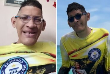 Venezolano con el pie más grande del mundo pide ayuda para costear su tratamiento: Advierte tener varios meses sin ponérsela (+Videos)